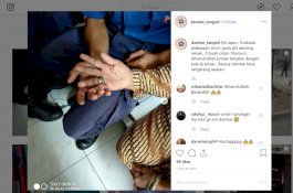 Petugas Damkar Turun Tangan Lepas Cincin Nenek yang Sumbat Darahnya