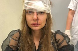 Penyanyi Gegar Otak Setelah Diserang Dokter di Ruang Operasi Plastik