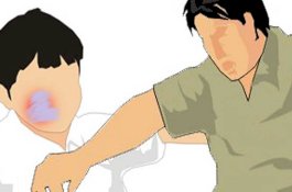 Tidak Tega Lihat Ibunya Dikasari, Adik Layangkan Tinju ke Wajah Kakak