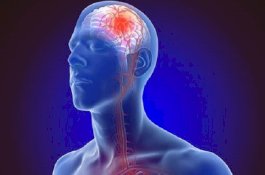 30 Hari Sebelumnya, Serangan Stroke Bisa Diprediksi