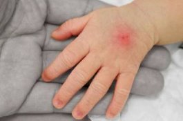 Balita yang Peluk Jasad Ibunya 3 Hari, Dikhawatirkan Terkena Virus