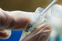 Mahasiswi Kedokteran Tewas di Asrama, Polisi Temukan DNA Pria di Tubuhnya