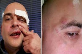 Bawa Tas Merah Muda, Pria Ini Dibonyok karena Disangka Gay