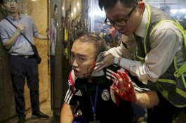 Pria Mengamuk Gigit Telinga Anggota Dewan Sampai Putus