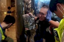 Awalnya Debat Politik, Pendemo Pro Beijing Gigit Telinga Pejabat Hong Kong hingga Putus