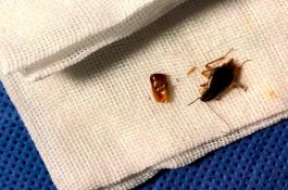 Lebih 10 Kecoak Hidup di Telinga Pria Ini