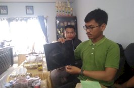 RSUD Bulukumba Tanggung Biaya Pengobatan Bayi Patah Tulang Akibat Kelalaian