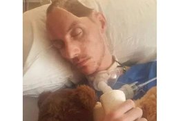 Korban Pemukulan Kehilangan Sebagian Tengkoraknya, Pelaku Hanya Dipenjara 72 Hari