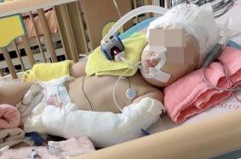 Dianiaya Pengasuh karena Terus Menangis, Bayi Perempuan Lumpuh Seumur Hidup