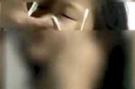 Di-bully, Mata Bocah Ini Dimasukkan Potongan Kertas