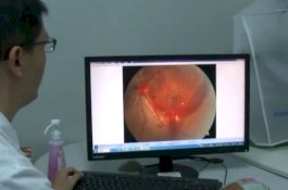 Keseringan Begadang Saat Main Smartphone, Mata Wanita Ini 'Meledak'