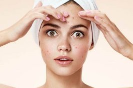 9 Letak Jerawat di Tubuh yang Bisa Tunjukkan Masalah Kesehatan