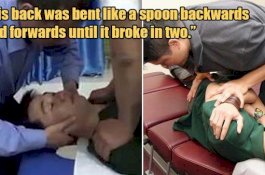 Ke Tukang Urut  untuk Luruskan Tulang, Kakek Ini Tewas dengan Leher Patah