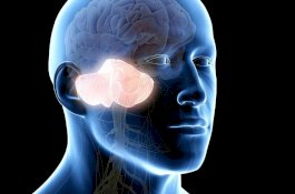 Bertahun-tahun Merasa Pusing, Wanita Ini Ternyata Tak Punya Otak Kecil