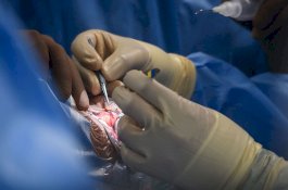 Pasien Meninggal Setelah Diberikan Organ Terinfeksi oleh Dokter