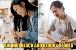 Wanita Ini Derita Kanker Perut Stadium Akhir Setelah Hemat Makanan Demi Kosmetik