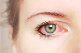 Matanya Gatal Bertahun-tahun, Rupanya Ada Cacing 7 Cm