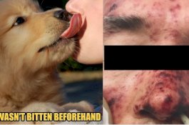 Pria Ini Meninggal Setelah Dijilat Anjing Kesayangannya