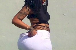 Gegara Suntikan Pembesar, Bokong Wanita ini Harus Diamputasi