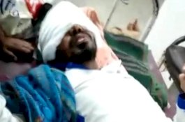 Cinta Ditolak, Si Gadis Siramkan Larutan Asam pada Pria Pujaan Hatinya