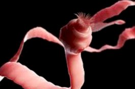 Gara-gara Daging Setengah Matang, Pria Ini 'Simpan' Cacing Pita di Otak