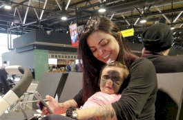 Dokter Berhasil Lepaskan Bercak Hitam Besar di Wajah 'Bayi Batman'