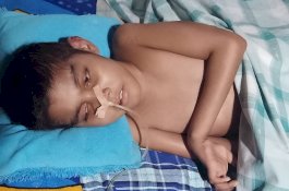 Menderita Radang Otak, Bocah Yatim Piatu di Pangkep Hanya Dirawat di Kolong Rumah