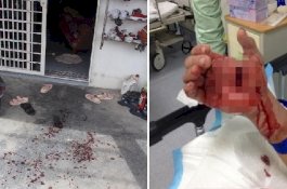 Terbangun Saat Lampu Menyala, Remaja Ini Ditebas 2 Perampok