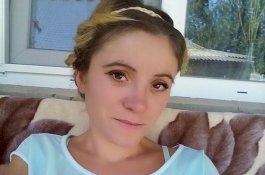 Lupa Beli Rokok, Wajah Wanita Ini Dibakar Suaminya