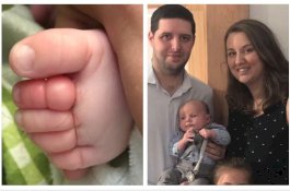 Kaki Bayi Ini Nyaris Putus Akibat Empat Jam Terbelit Rambut Gugur Ibunya