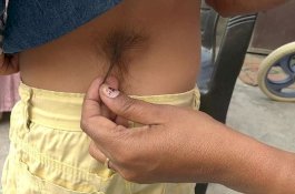 Punya Ekor, Bocah ini Dipuja Sebagai Reinkarnasi Dewa Monyet Hanuman