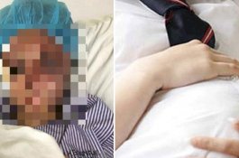 Minta Dinikahi, Wanita Muda yang Hamil 5 Bulan Ini Malah Dianiaya Pacar di Jalanan