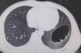 Dipukul Pacar, Organ Pria Ini Bergeser