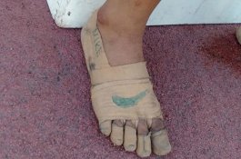 Balut Kakinya dengan Plester Berlogo 