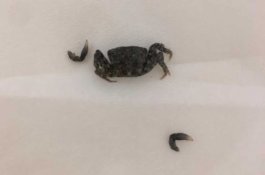 Liburan di Pantai, Telinga Pria ini Dimasuki Kepiting