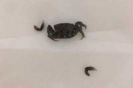 Kepiting Masuk ke Dalam Telinga Pria Ini saat Berjemur di Pantai