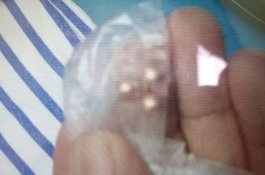 Tangkis Peluru Pakai Tangan, Pedagang Ini Angkat Proyektil di Pipi lalu Kembali Berjualan