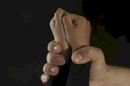 Luka-Luka Usai Dikeroyok, Sampai di Rumah Sakit Pria 50 Tahun Ini Dipukuli Bocah hingga Tewas