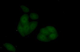 Ahli Temukan Protein yang Memacu Pertumbuhan Kanker Usus 