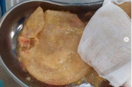 Begini Penampakan Implan Payudara Presenter Cantik yang Bocor, Berani Lihat?