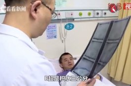 Dokter Ini Menahan Rasa Sakitnya Sendiri Demi Selamatkan Nyawa Pasien