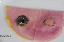 Tak Sengaja Telan Baterai, Tenggorokan Bocah Ini Terbakar