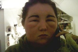 Gara-gara Pewarna Rambut, Wajah Wanita Ini Membesar