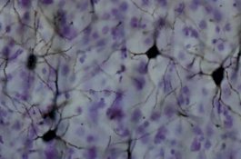 Ternyata Ada Sinyal Jenis Baru di Otak Kita