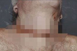 Leher Berlumuran Darah: Foto-foto Jeffrey Epstein Saat Ditemukan Tewas di Penjara