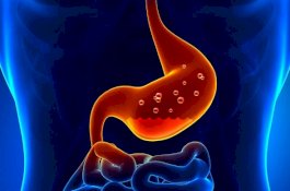 Kurang Gerak Penyebabb Asam Lambung