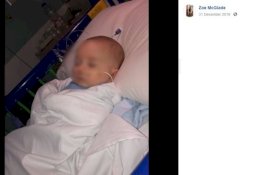 Bayi Lucu Ini Terkena Infeksi Mematikan Usai Dicium Sembarang Orang