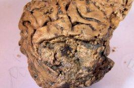 Ilmuwan Terkejut, Otak Berusia 2.600 Tahun ini Tidak Membusuk