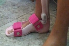 Negara Tolak Bayar, Veteran Tentara Ini Kembalikan Kaki Tiruannya ke Toko