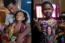 Tuhan Titip Kesembuhan Gadis Jeneponto Ini pada Wagub Sulsel